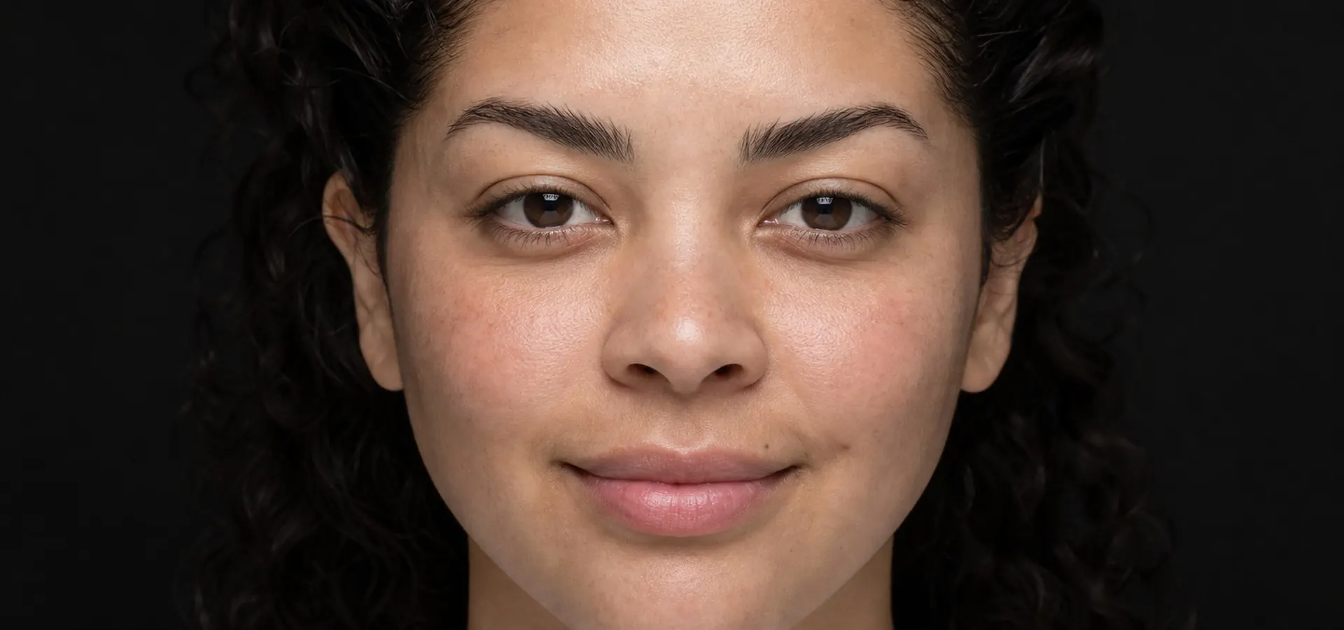 AviClear Acne Treatment