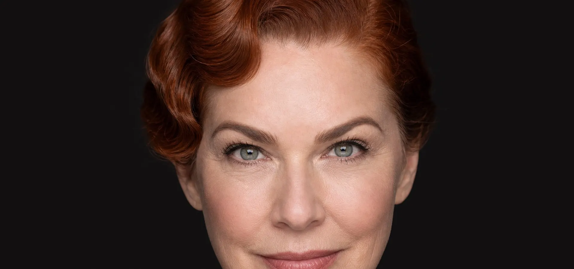 Brow Lift