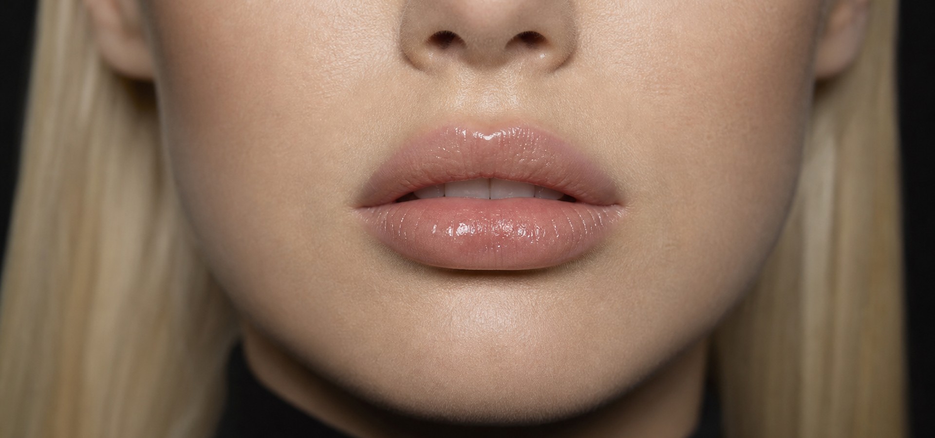 Lip Augmentation